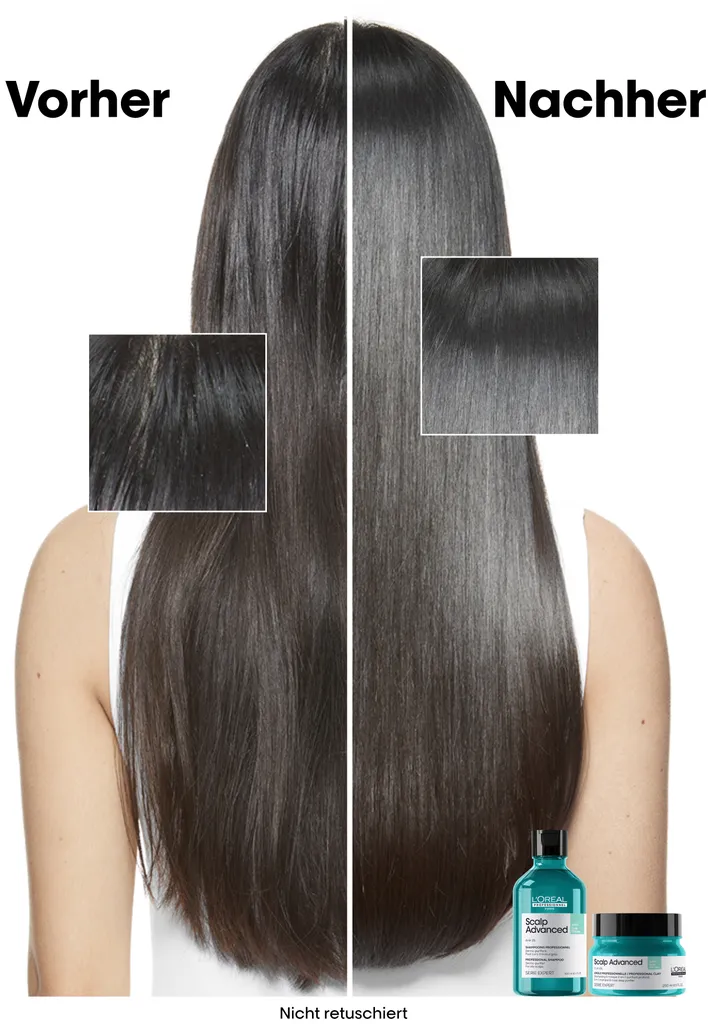 L'Oréal Scalp Advanced Anti-Oiliness 2-in-1 Deep Purifier Clay