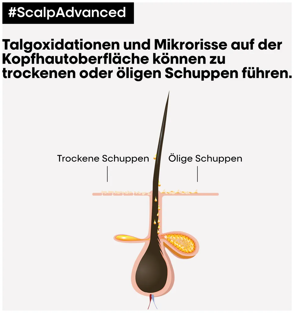 L'Oréal Scalp Advanced Anti-Dandruff Dermo-Clarifier Shampoo