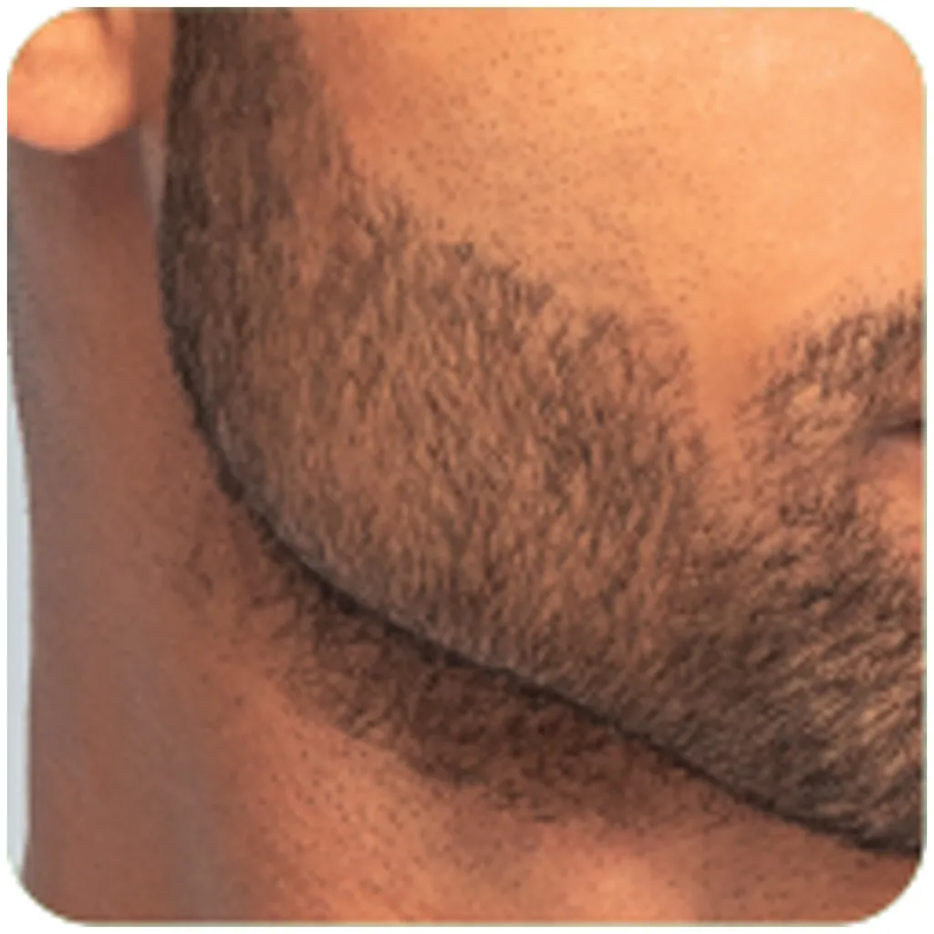 Remington T-Series Ultimate Precision Bartschneider MB7000