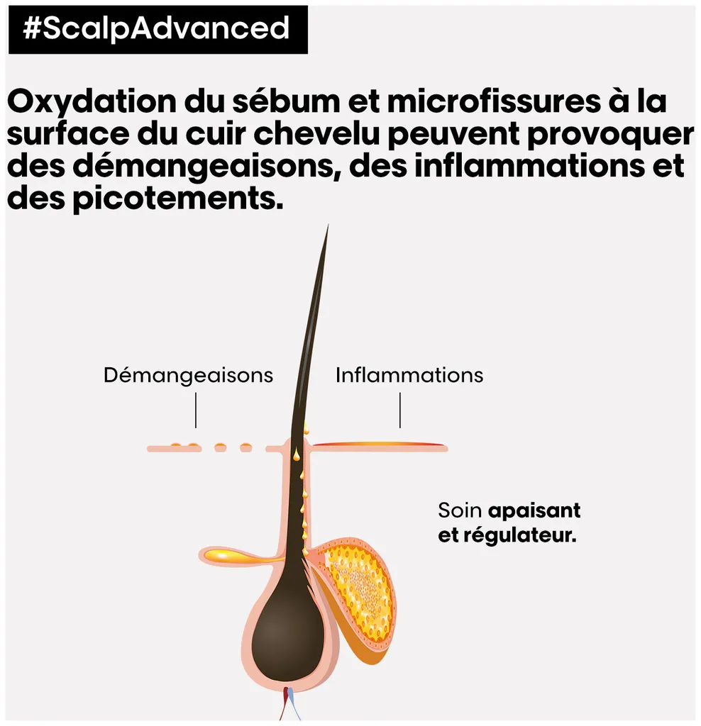 L'Oréal Scalp Advanced Anti-Discomfort Intense Soother Treatment