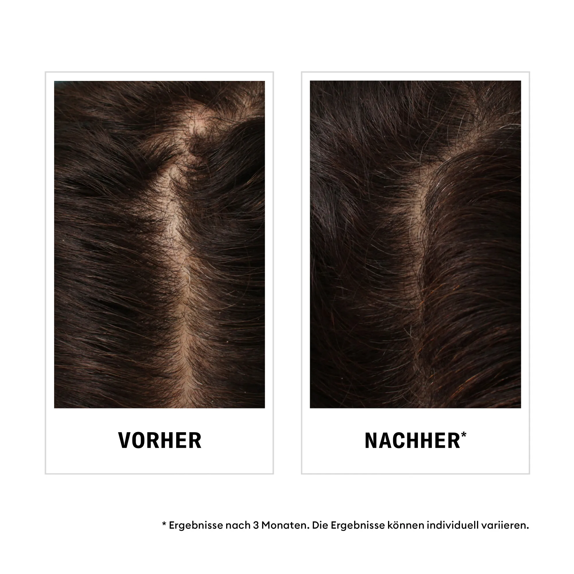 Nioxin Hair Fall Defense Shampoo