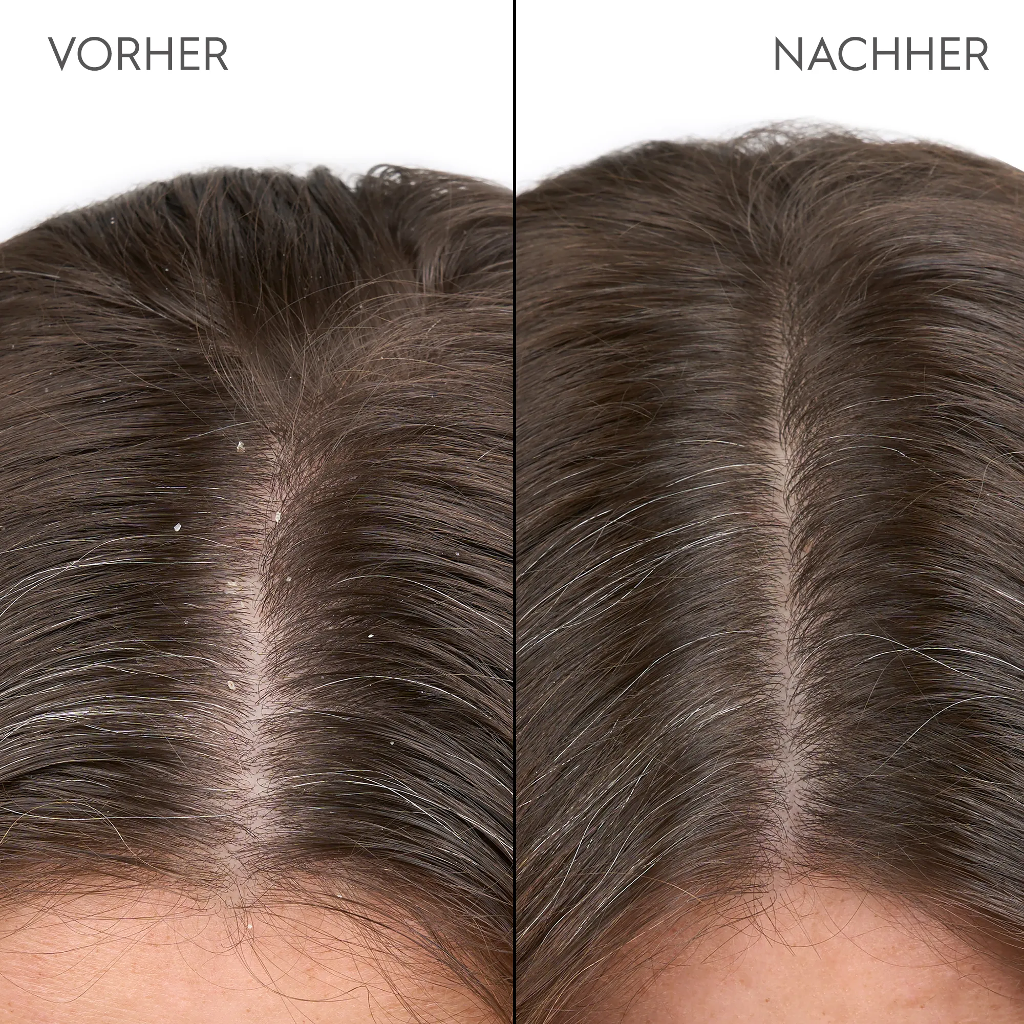 Kerasilk Anti-Schuppen Kopfhaut Serum